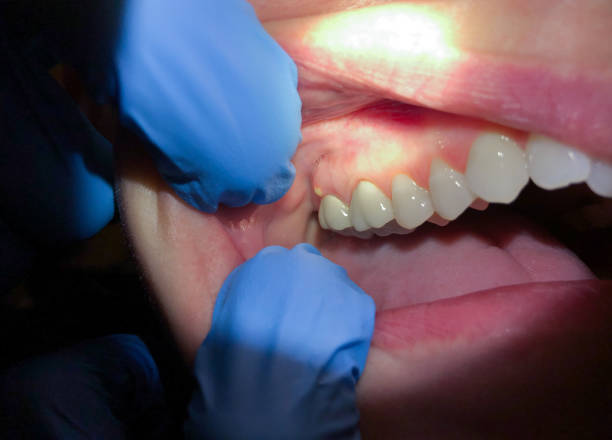Best Emergency Treatment for Jaw Pain or Injury in Clay City, KY